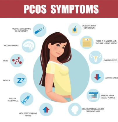 Polycystic Ovarian Syndrome